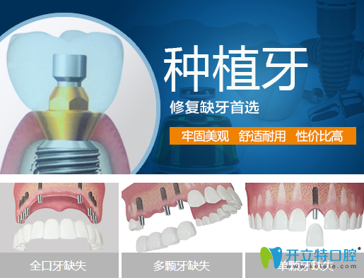牙齒缺失說話漏風(fēng)？德陽新橋口腔種植牙幫你改善缺牙問題