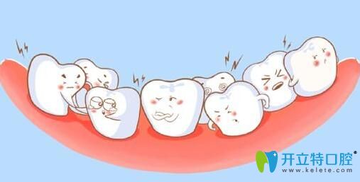 阜陽(yáng)貝得口腔做成人牙齒矯正和兒童牙齒矯正有什么不同？