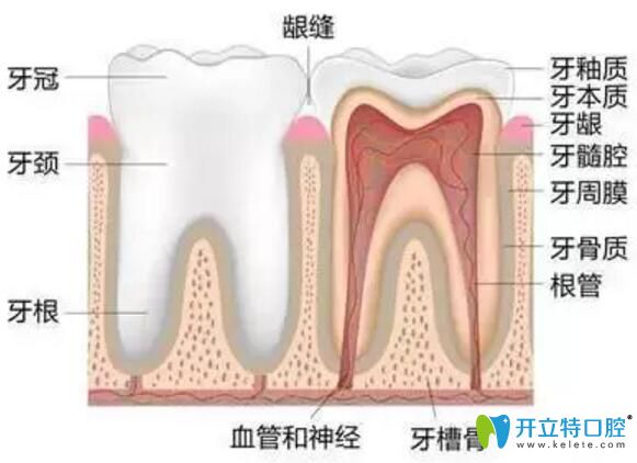 牙齒根管治療的介紹