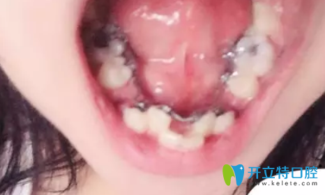 在深圳格倫菲爾（唐?。┛谇话窝绖偞餮捞? width=