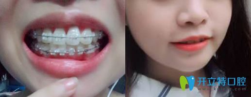 的.jpg