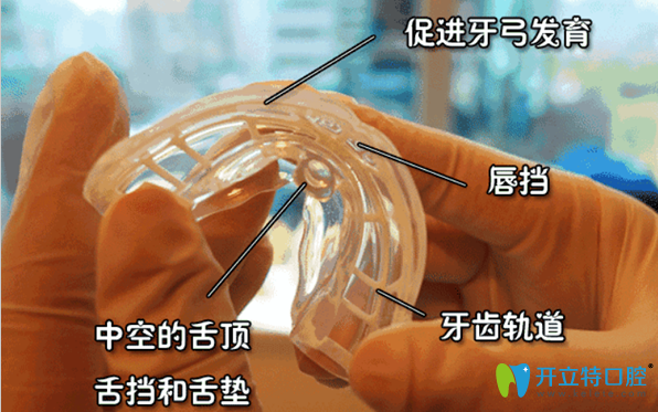 MRC肌功能矯治器的結(jié)構(gòu)和優(yōu)勢(shì)