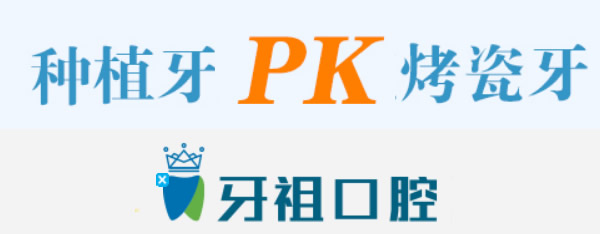 烤瓷牙和種植牙哪個(gè)好 長(zhǎng)沙牙祖口腔詳述兩者的區(qū)別+優(yōu)劣勢(shì)