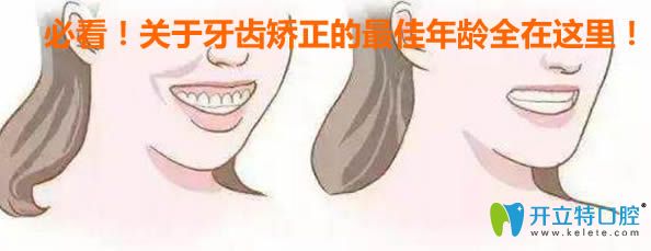 內(nèi)幕！如果錯過了牙齒矯正的較佳年齡，會讓你后悔一輩子