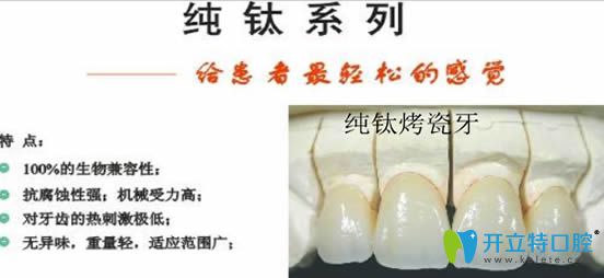 palmspringsgreathomes.com純鈦烤瓷牙圖片