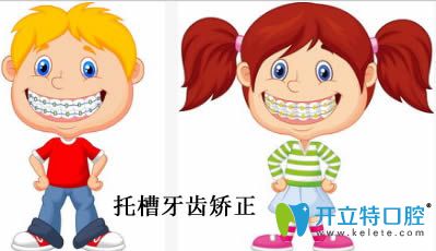 開立特口腔托槽牙齒矯正動畫圖