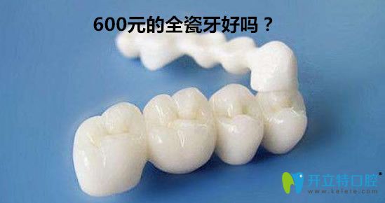 600元的全瓷牙好嗎？全瓷牙套1000一顆貴嗎