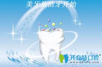 開(kāi)立特口腔潔牙的價(jià)格是多少錢(qián)