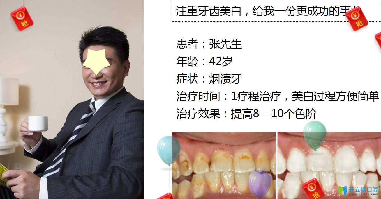 深圳牙齒美白哪里做？格倫菲爾口腔皓齒美白案例公布