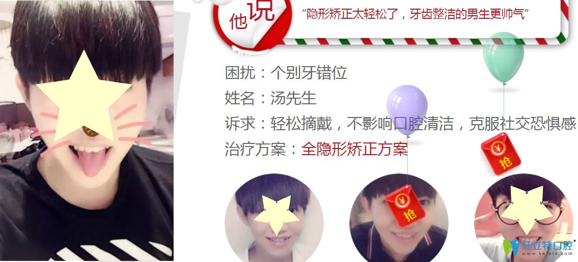 深圳格倫菲爾口腔水平怎么樣？看牙齒正畸真人案例反饋