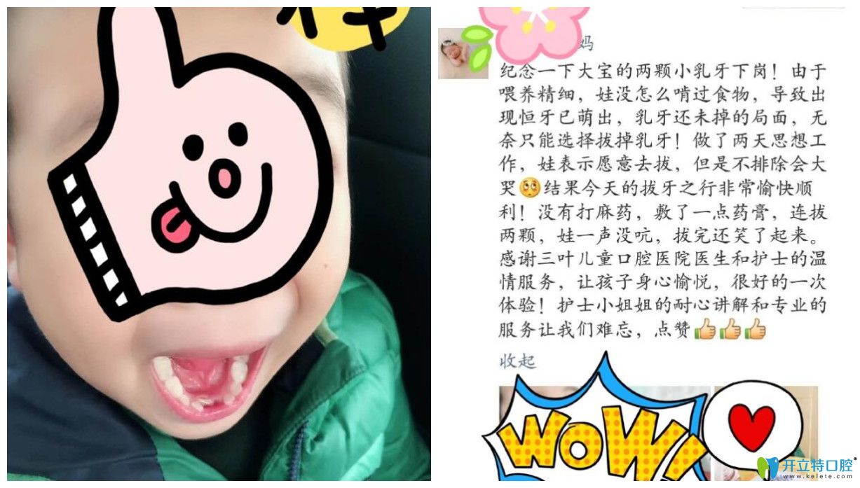 孩子在三葉進(jìn)行治療后家長點(diǎn)評