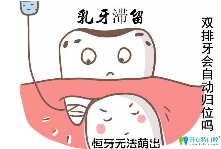 兒童出現(xiàn)了雙排牙怎么辦，會不會自從歸位