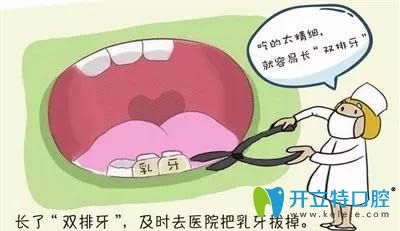 雙排牙需要到及時進行拔除