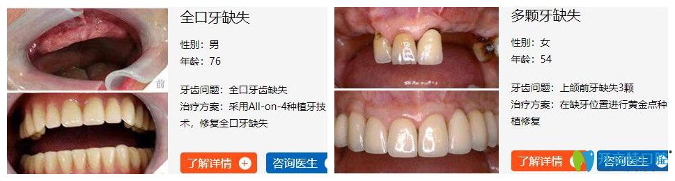 海濤口腔種植牙怎么樣？<span style=