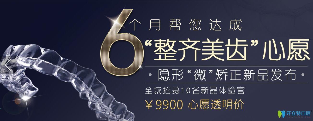 上海英博口腔快速矯正牙齒技術—矯正僅需6個月,招募體驗官