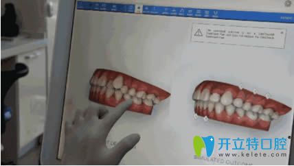 茅來(lái)發(fā)醫(yī)生講解牙齒正畸中的影像分析