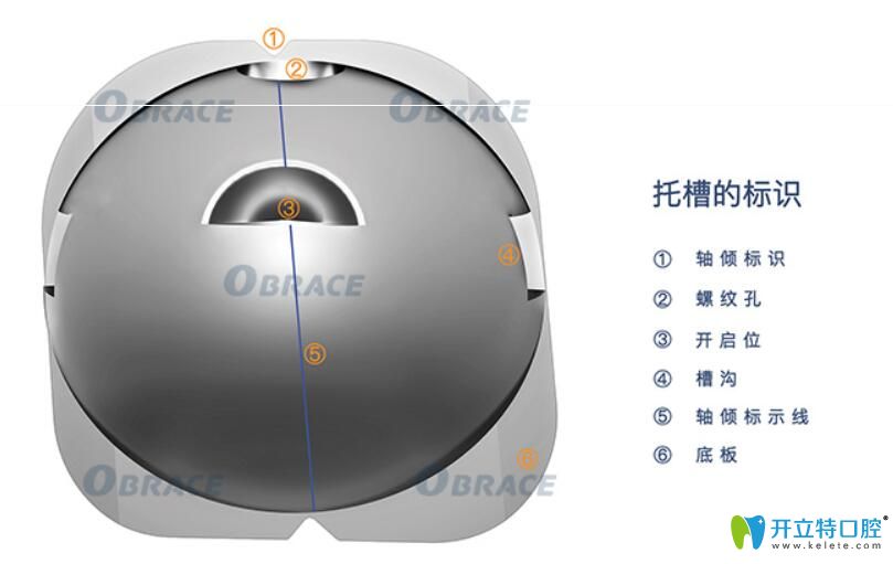 為什么要選擇obrace球面自鎖托槽矯正牙齒？答案在這里……
