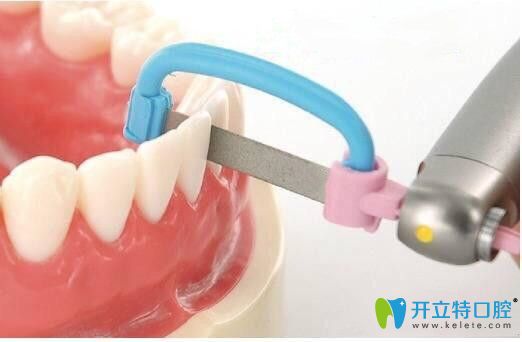 請看：正畸中鄰面去釉對牙齒有危害嗎？