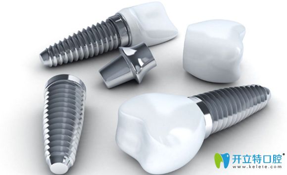 在十大種植牙排名中的美國皓圣對比百康種植體該選哪一個?