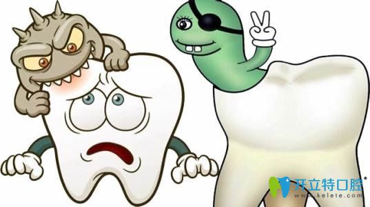  葉賢浩醫(yī)生科普為什么要補牙？補牙疼不疼？