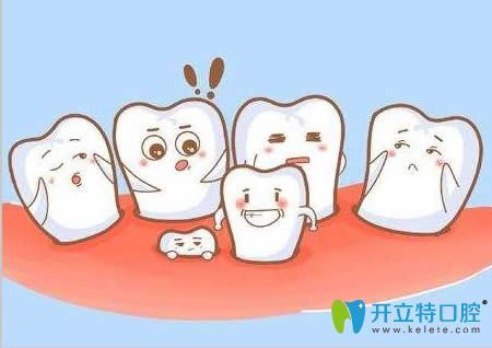 拔牙后的口腔注意事項介紹