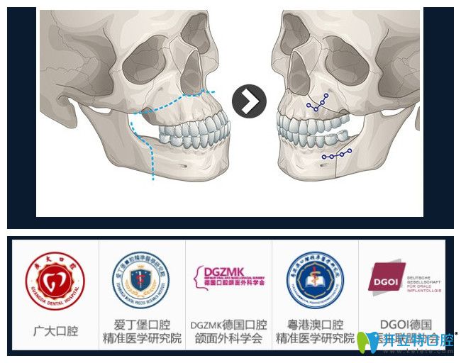 V-LINE正領聯(lián)合變臉術