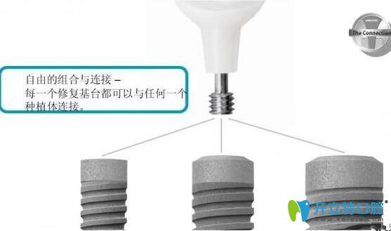 德國ankylos種植系統(tǒng)基臺特點