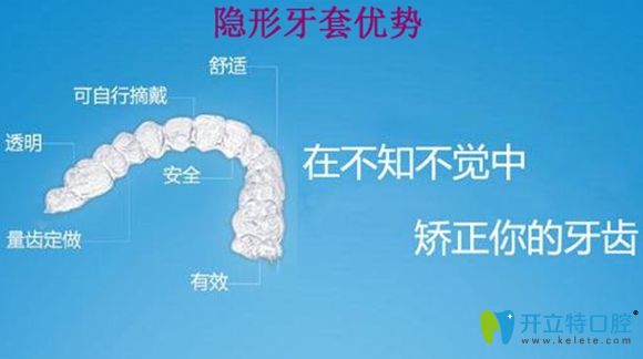 隱形牙套的優(yōu)點介紹圖