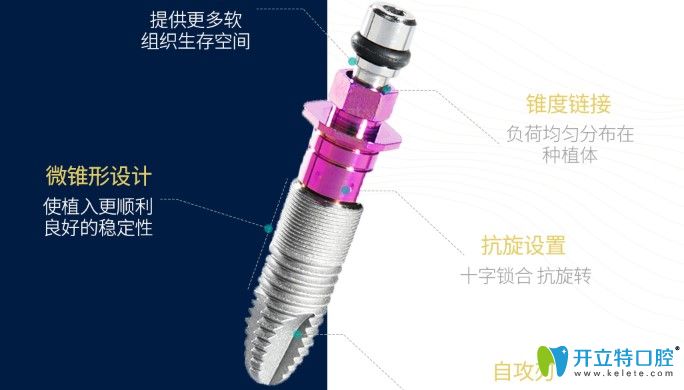 維樂口腔種植牙材料優(yōu)勢
