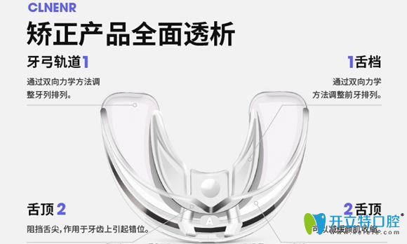 德國(guó)clnenr可林爾隱形牙套示意圖