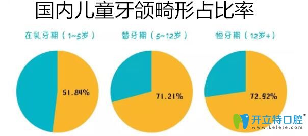  5種常見的牙頜畸形圖片和治療方法,值得收藏哦！