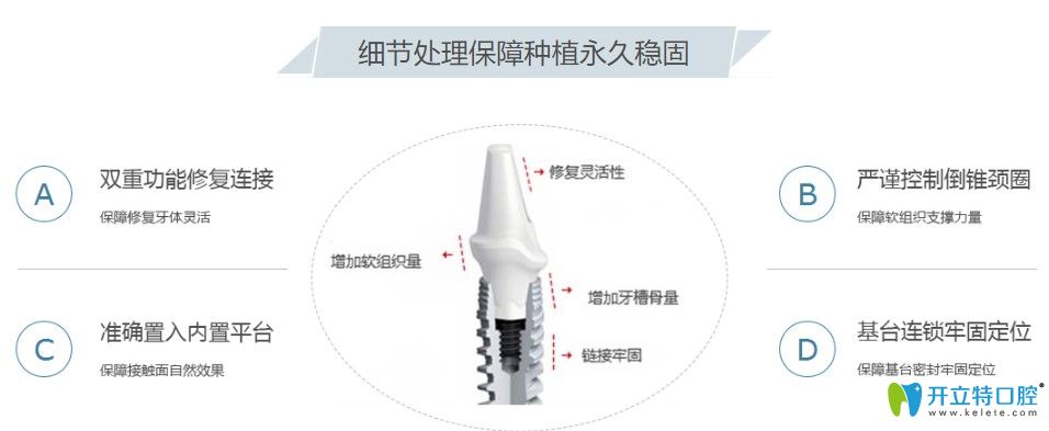 優(yōu)貝口腔的設備先進細節(jié)處理到位