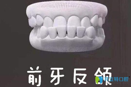 牙齒地包天能自我矯正嗎？牙齒反頜的矯正方法了解一下吧