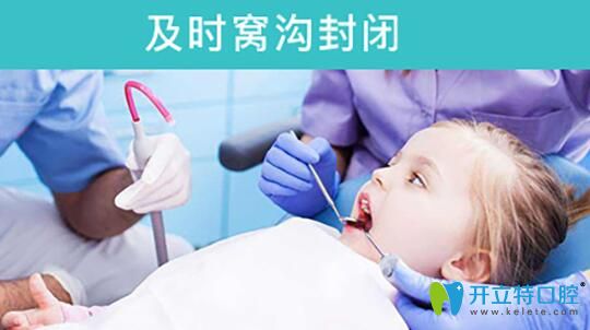 青島維樂(lè)萬(wàn)琳介紹窩溝封閉