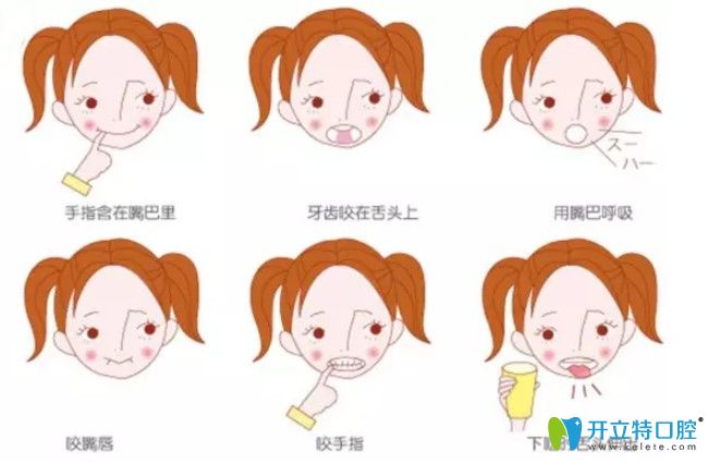 咬合誘導(dǎo)技術(shù)都有哪些？兒童咬合誘導(dǎo)有啥副作用？