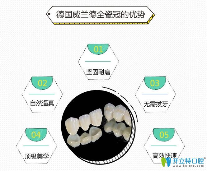 德國威蘭德全瓷牙優(yōu)點(diǎn)