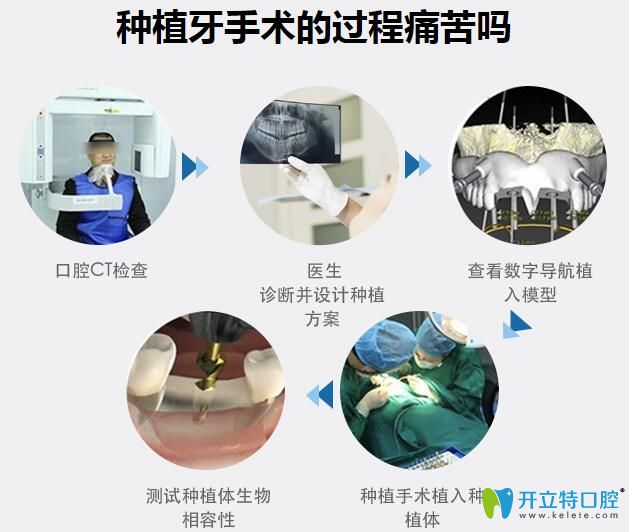 無錫維樂口腔黃旭光種植牙手術(shù)過程