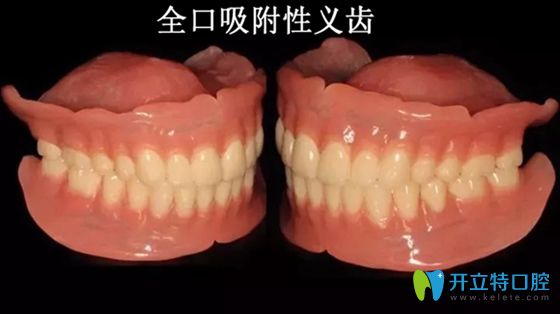武漢仁愛口腔知識科普:吸附性義齒和普通義齒的區(qū)別及利弊