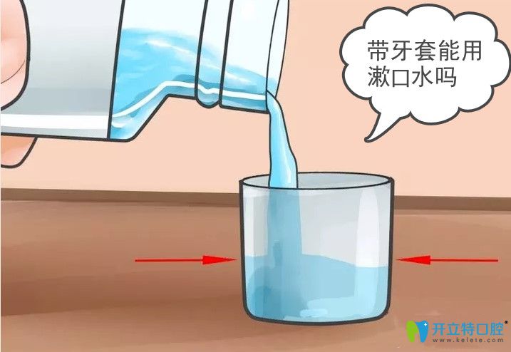 正畸帶了鋼牙套是不是要用漱口水？小姐姐們趕緊get起來吧