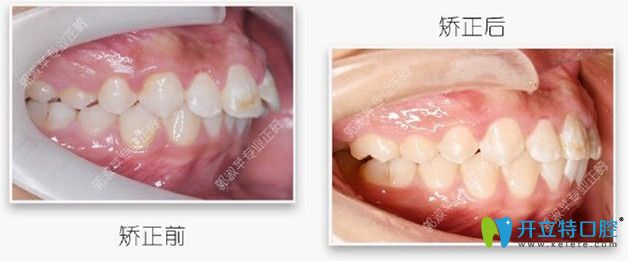 對(duì)比下矯正前后的照片，效果還是不錯(cuò)吧