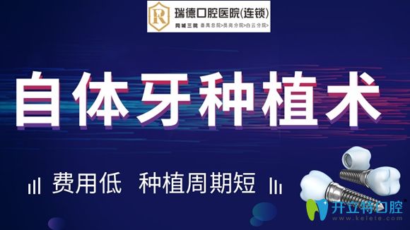 今日話題:自體牙移植技術(shù)將成為缺牙修復的新寵兒!