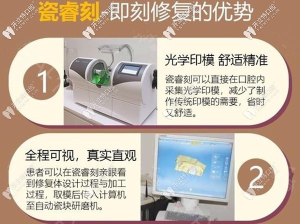瓷睿刻即刻修復的優(yōu)勢