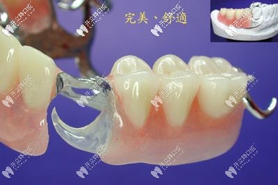 干貨來(lái)了：同為臨時(shí)牙冠的即刻義齒和臨時(shí)義齒有區(qū)別嗎？