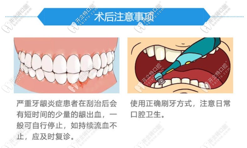 齦下刮治的副作用