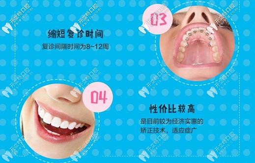 金屬矯正的優(yōu)勢(shì)