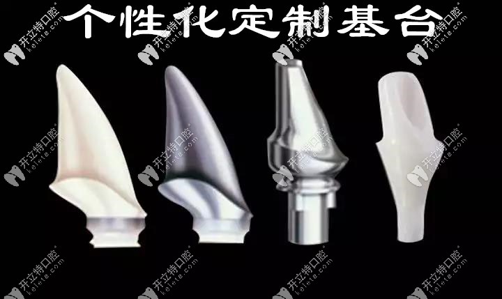 種植牙的個(gè)性化定制基臺(tái)