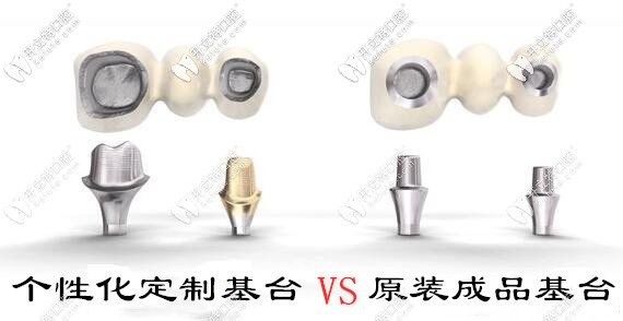 種植牙個(gè)性化基臺(tái)和成品基臺(tái)的區(qū)別