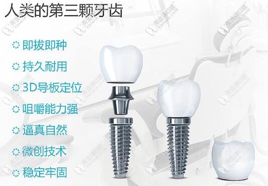 沈陽(yáng)歡樂(lè)仁愛(ài)口腔種植牙價(jià)格表