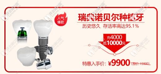西安諾貝爾齒科瑞典諾貝爾種植體活動價(jià)格
