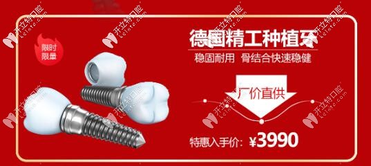 西安諾貝爾齒科德國種植牙活動價(jià)格
